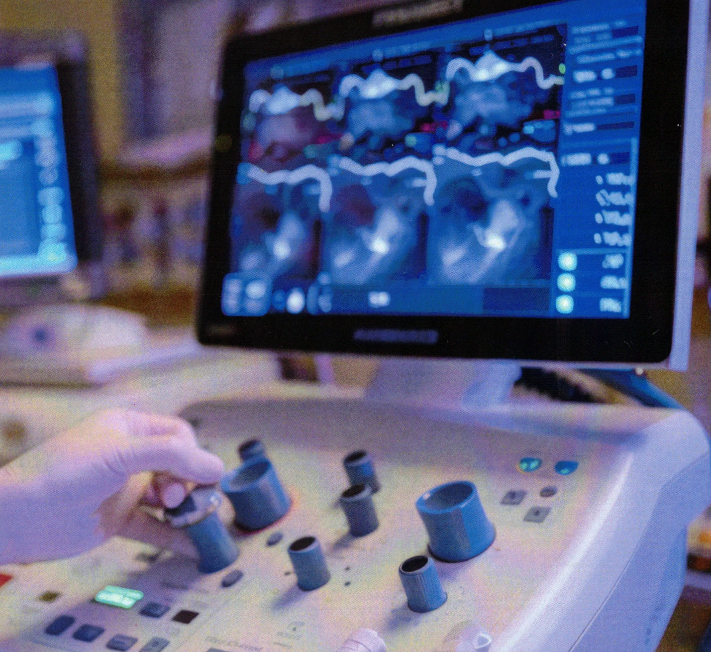 Ultrasound equipment pictured in the Alpha Mobile Ultrasounds brochure